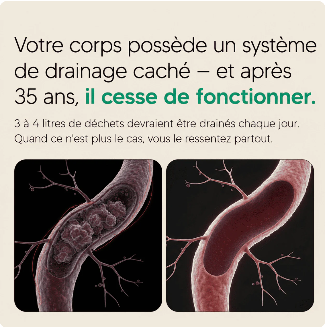 Gélules de Drainage Lymphatique · Transformation totale en 60 jours