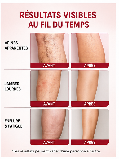 AFRALIS VeinCare™ – Crème Jambes Légères & Veines Apparentes